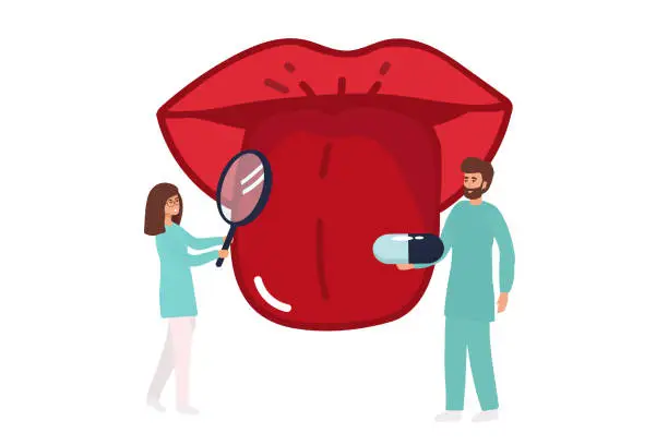 Vector illustration of Open mouth with protruding tongue, checkup health tongue doctor. Tongue and disease. Vector illustration