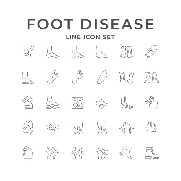 ilustraciones, imágenes clip art, dibujos animados e iconos de stock de establecer iconos de línea de enfermedad del pie - physical therapy human spine symbol medical exam