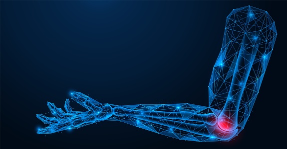 Inflammation and pain in the elbow joint. Polygonal design of interconnected lines and points. Blue background.