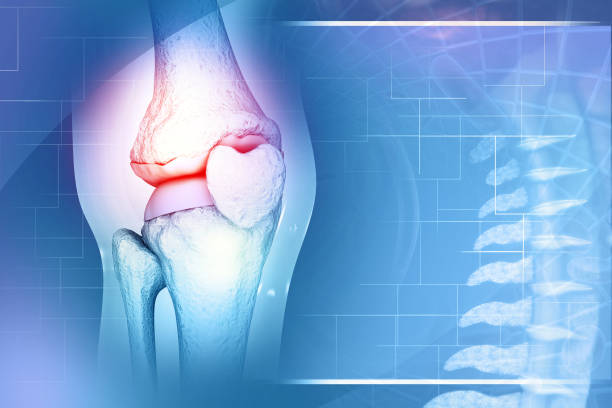 istock 3d rendered medically accurate illustration of an arthritic knee joint 1455919463