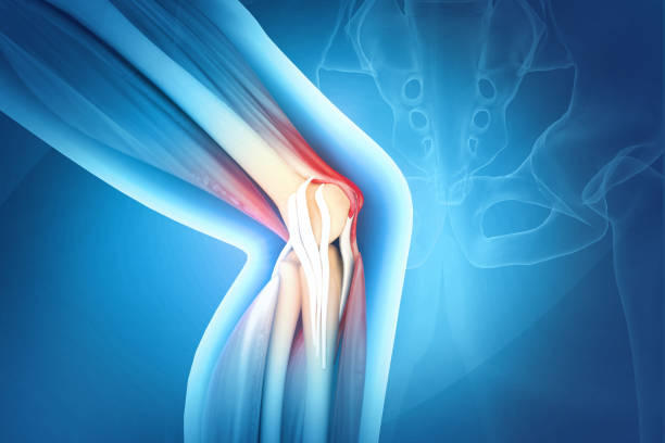 istock Pain in knee joint. Tendon problems and Joint inflammation on dark background. 3d illustration 1455919802