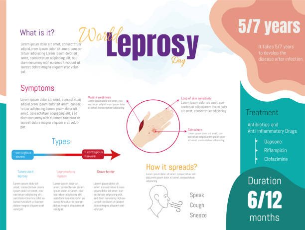 Leprosy vector illustration Leprosy vector illustration. Labeled schematic of bacterial infection medical disease. List of symptoms such as loss of sensation, ulcers and muscle weakness. How it is spread and treatment. leprosy stock illustrations