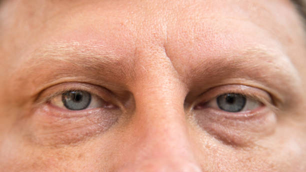 istock Male eyes with light eyelashes and eyebrows, close-up 1455971791