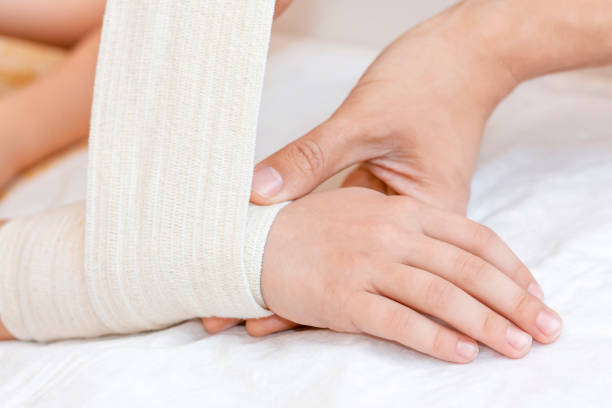 gebrochenes handgelenk mit verband im krankenhausbüro. arzt verbindet gliedmaße des patienten. verstauchung, stressfraktur, trauma in der hand. kind gebrochener arm. krankenschwester hilft kunde. erste hilfe. - male nurse fotos stock-fotos und bilder