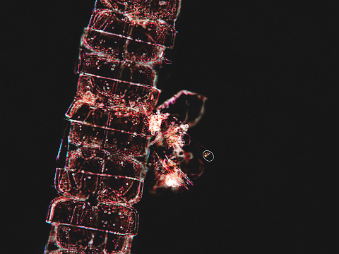 Algae with zooplankton under microscopic view, dark background