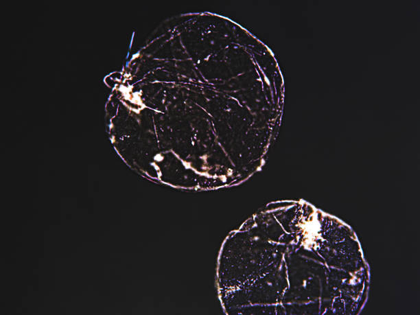 istock Noctiluca scintillans algae cells algae under microscopic view, bioluminescent, giving the water a bright blue glow seen at night, responsible for environmental hazards, such as toxic red tides and eutrophication, dark background 1456545066