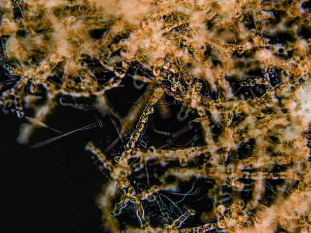 Microbio Syphilis 120+ Syphilis Microscope Stock Photos, Pictures & Royalty-Free Images ...