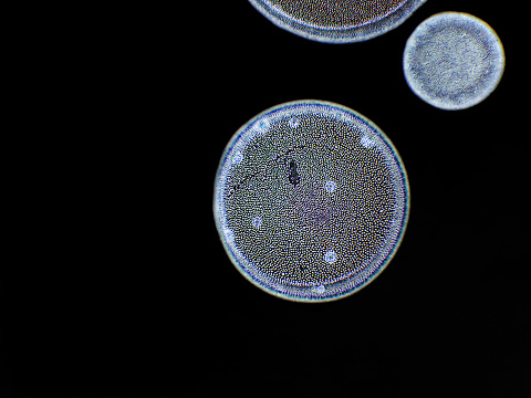 Volvox sp. algae under microscopic view, dark background