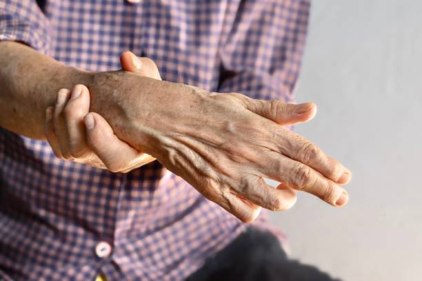 istock Ulnar claw hand of Asian woman. It develops due to ulnar nerve damage . 1456576852