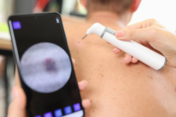 istock Man removes pigmentation on back in cosmetic clinic 1456684062