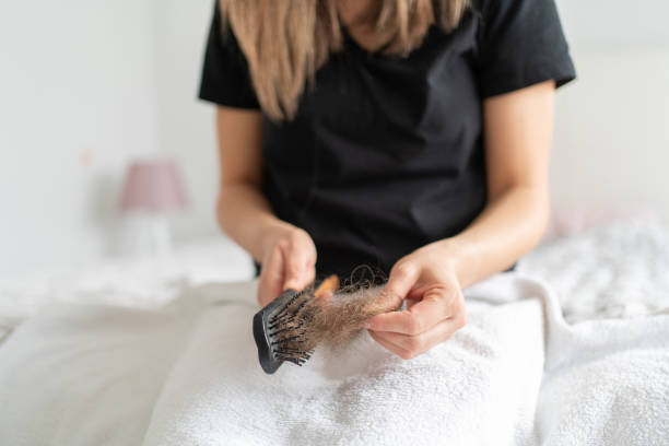 Hair Loss Woman Stock Phot. Woman Cleaning Her Hair With A HairBrush İn Her Hand hairbrush stock pictures, royalty-free photos & images