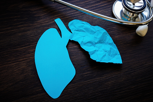Stethoscope and one crumpled paper lung as ground glass opacity after covid.