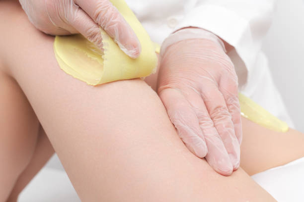 Closeup of cosmetologist hands doing depilation to woman legs with green hot wax in beauty salon stock photo
