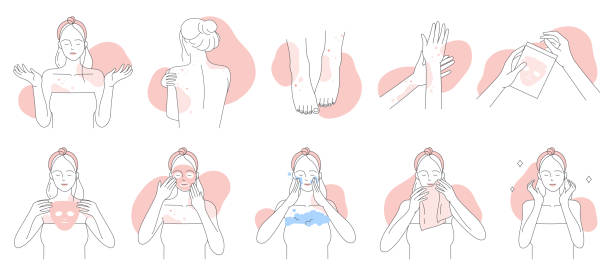 ilustraciones, imágenes clip art, dibujos animados e iconos de stock de alergia, síntomas e iconos de línea de tratamiento establecidos, las niñas sufren de dermatitis alérgica - body care body the human body female