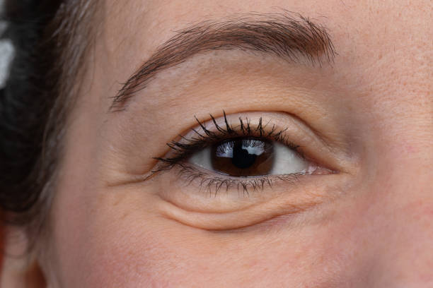 macro of a female eye with eye bags - wrinkles eyes imagens e fotografias de stock