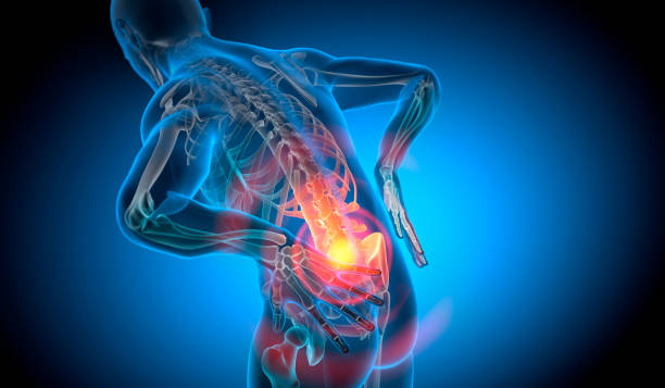 back pain-conceptual artwork-3d illustration - dor de costas imagens e fotografias de stock