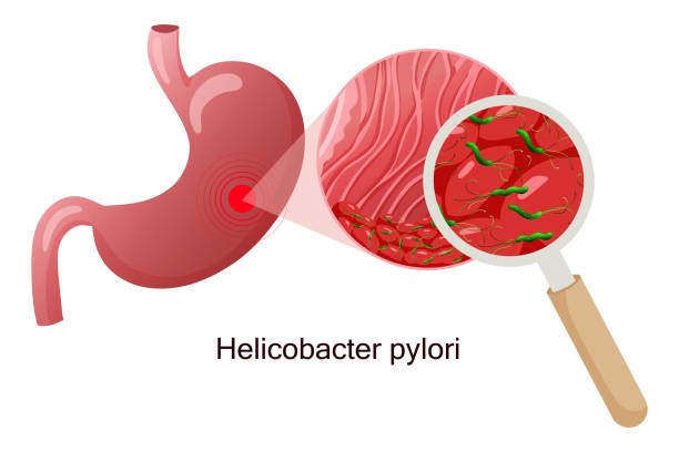 ilustraciones, imágenes clip art, dibujos animados e iconos de stock de helicobacter pylori en la mucosa del estómago bajo lupa. ilustración vectorial, estilo de dibujos animados, fondo blanco - pylori