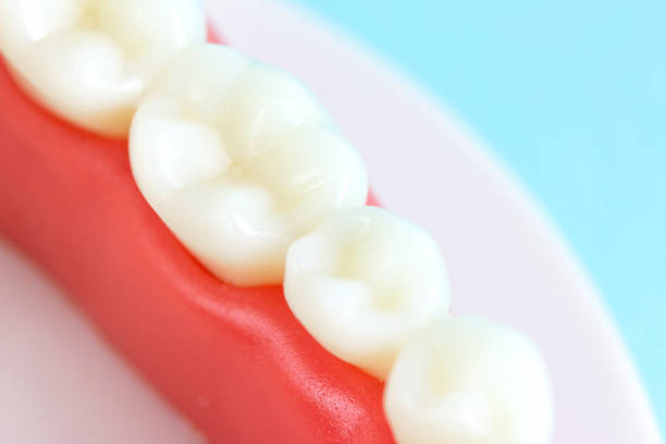 istock Dental Teeth Model dentures on blue background, close-up.Regular checkups are essential to oral health. Orthodontic tools, brace, bracket system, tooth, 1457457695