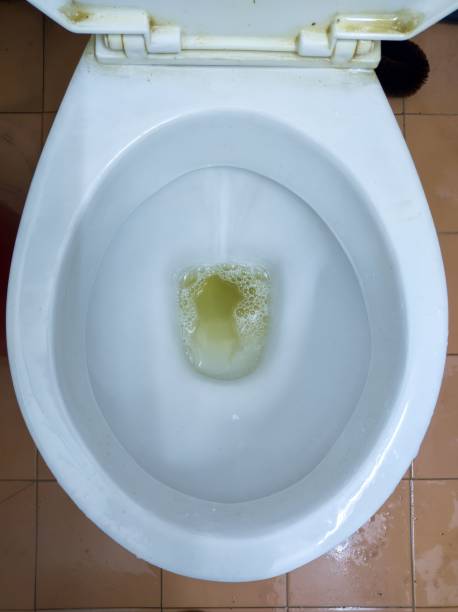 istock Yellow and frothy urine. 1457545883