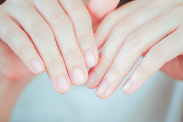 istock Close-up of woman's fingernail. Hand concept. 1457613168