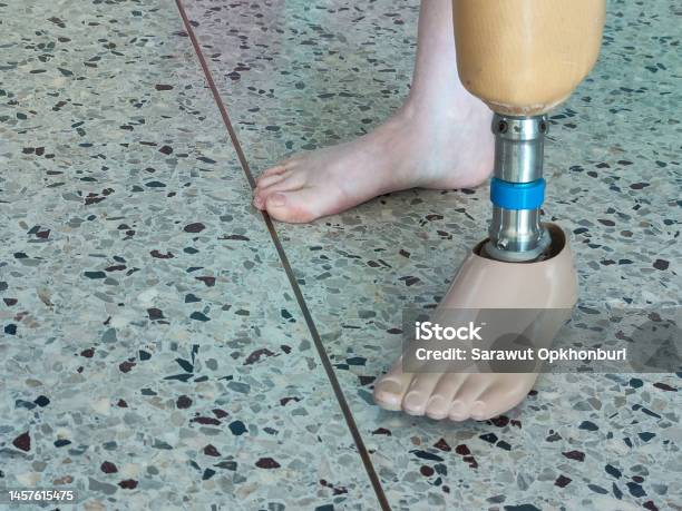 Bk Disability Using And Training Leg Prothesis Stock Photo - Download Image Now - Active Lifestyle, Adult, Amputee