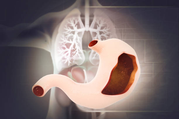istock Human stomach anatomy. 3d illustration 1457622690