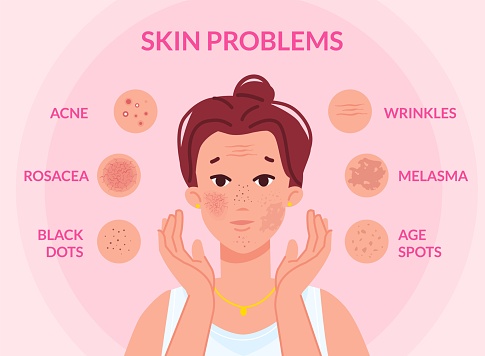 Types skin problems. Woman face with skins troubles, melasma pimple blemishes acne teenager problem blackhead cosmetic wrinkle spot scar facial redness, vector illustration of woman skin trouble