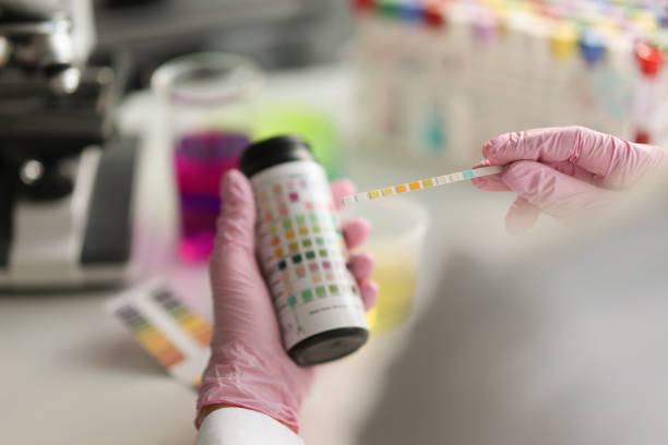 Doctor holds reagent strip for urinalysis closeup Doctor holds reagent strip for urinalysis closeup. Control analysis of urine in laboratory concept anti doping stock pictures, royalty-free photos & images