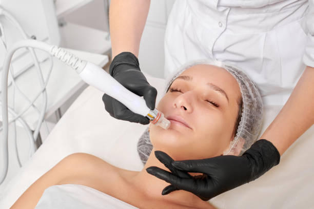 Cosmetologist makes aqua exfoliation for rejuvenation woman face skincare, procedure in beauty salon stock photo