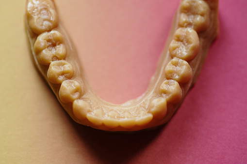 New teeth produced in the dental laboratory