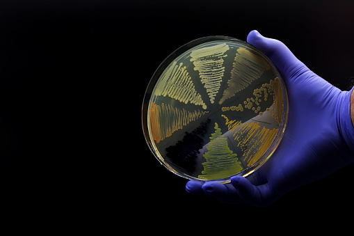 Hand of doctor or researcher holding a plate of microbiological cultures with colored bacteria. Concept of antibiotic resistance