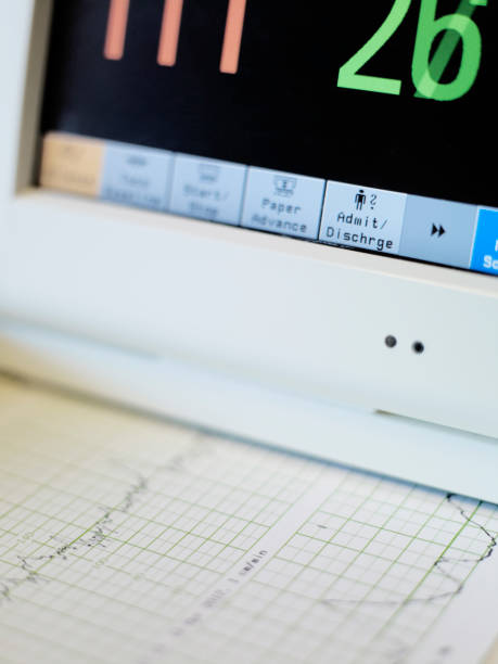 monitor utilizzati in chirurgia cardiologica - human heart pulse trace heart valve cardiac conduction system foto e immagini stock