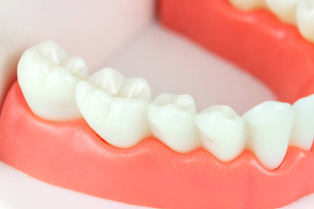 istock False teeth, jaws. Teeth model dentures on blue background, close-up. Dental healthcare concept. Close-Up Of Dentures Against Blue Background. Denture picture with focus on teeth on blue background. 1457975113