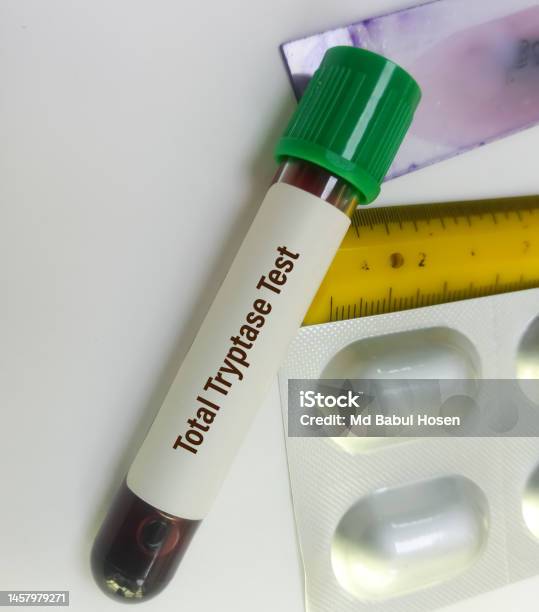 Tryptase Testing Blood Sample For Total Tryptase Test A Tryptase Test Can Help Doctors ...