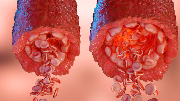 vasoconstricción y vasodilatación presión arterial, dilatación de los vasos sanguíneos o capilares o arterias, aumento y disminución del flujo sanguíneo a través de los vasos sanguíneos, diferente grosor, 3d render - nitric oxide fotografías e imágenes de stock