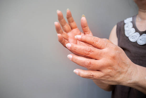 ältere frau, die an schmerzen, taubheit oder schwäche in den händen leidet. - pain joint human hand arthritis stock-fotos und bilder