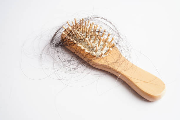 istock Hair loss fall with comb brush isolated on white background. 1458149337