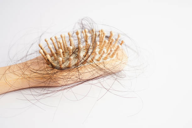 istock Hair loss fall with comb brush isolated on white background. 1458150734