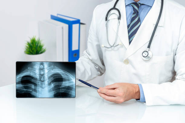 traumatologist doctor showing and explaining a digital chest radiography with a tablet in the office. health insurance concept. - sleutelbeen-fotos stockfoto's en -beelden