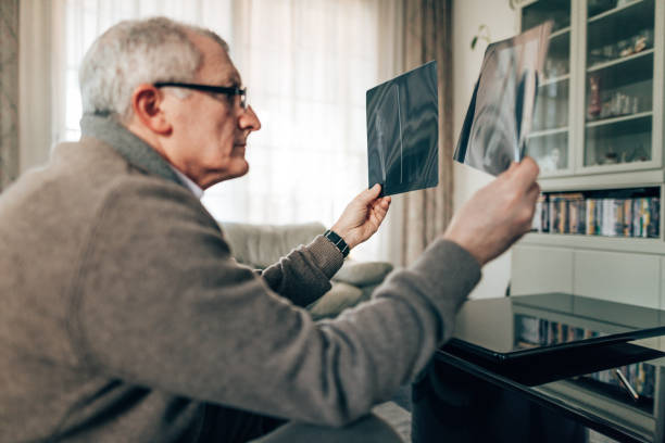 istock doctor watching the xray at home 1458244195