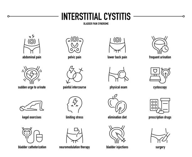 간질 성 방광염 벡터 아이콘 세트입니다. 라인 편집 가능한 의료 아이콘. - interstitial stock illustrations