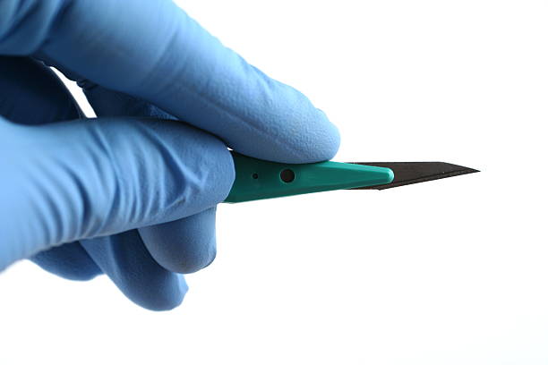 gloved hand holding scalpel stock photo