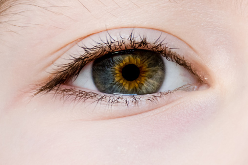 A young boy's eye showing his Central heterochromia . Some parts of his eye are blue and other parts are brown.