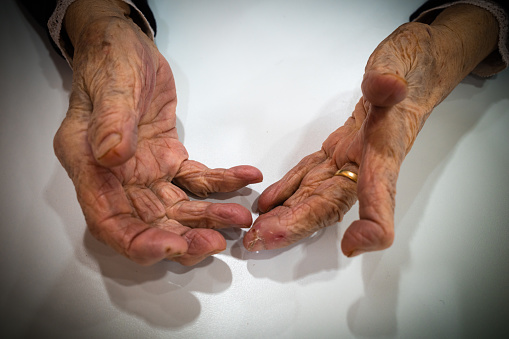 Close up of the hands of an old wife