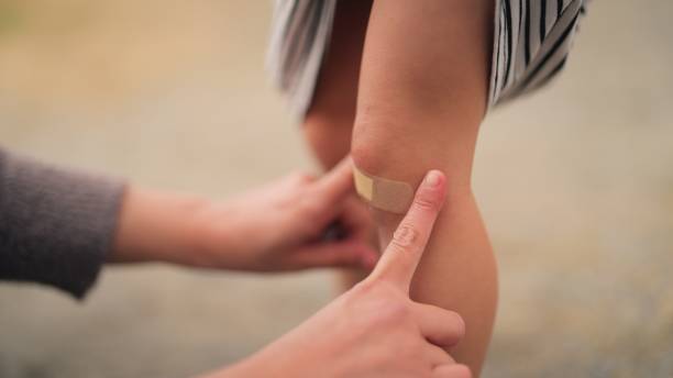 mãe cobrindo ferida de sua filha pequena com bandaid em parque público - membro humano - fotografias e filmes do acervo