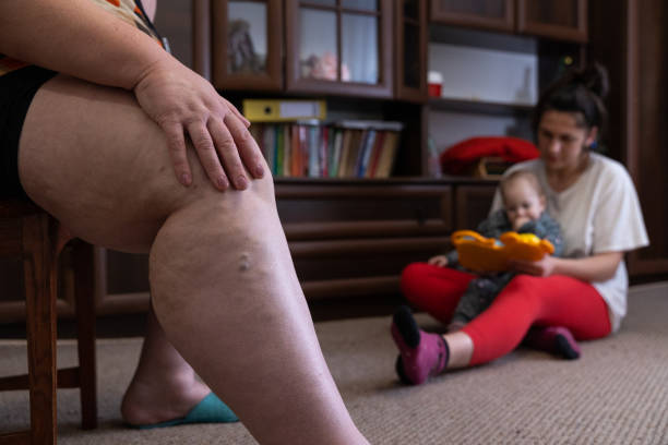Mature woman massaging her leg with varicose veins. Mature woman sits on a chair and rubs her leg with varicose veins. Young woman is playing with her baby in the living room. obese joint pain stock pictures, royalty-free photos & images