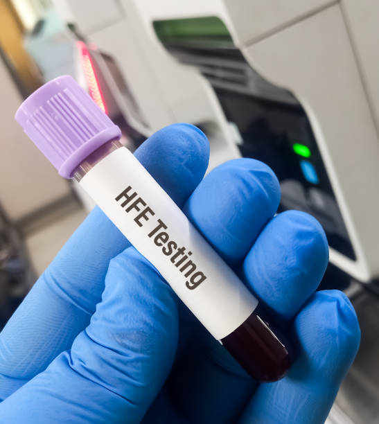 istock Blood sample for HFE(Hemochromatosis gene) testing, to diagnosis autosomal recessive iron storage disorder. Genetic diagnosis of hereditary hemochromatosis. 1458950692