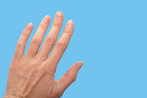 Close-up of a woman's age-old hand with wrinkles with natural nails, overgrown cuticle on blue background