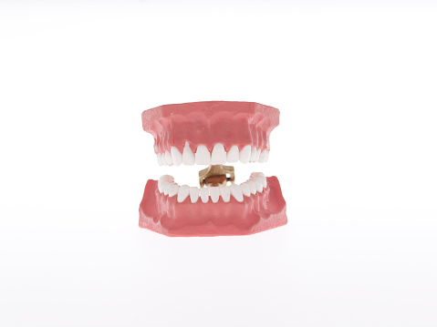 Traumatic Occlusion. Medically accurate 3D illustration