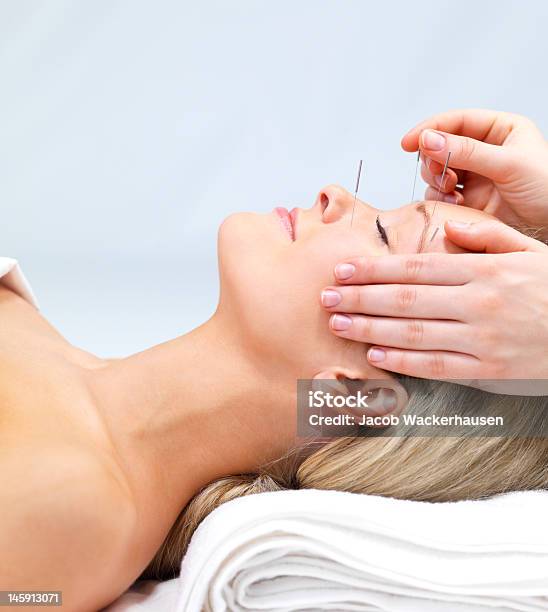 Beautiful Young Woman Lying Down Receiving Acupuncture Therapy Stock Photo - Download Image Now